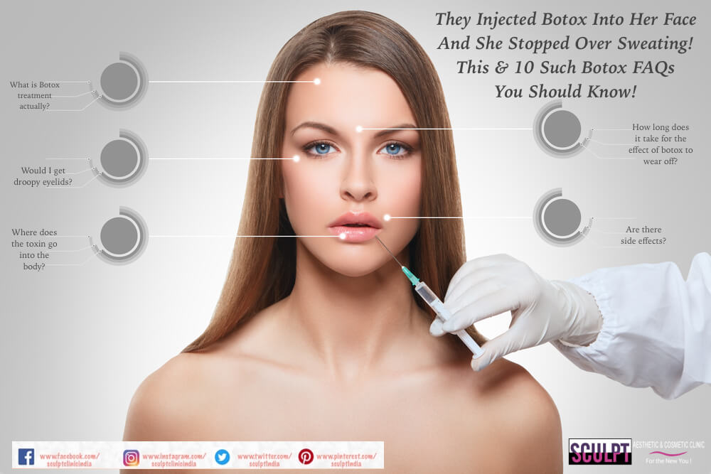 10 Botox FAQs to blow your mind