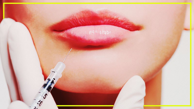 Preventative Botox – Actually helpful or just a fad?