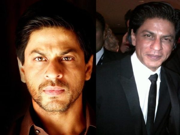 SRK after Botox and surgeries